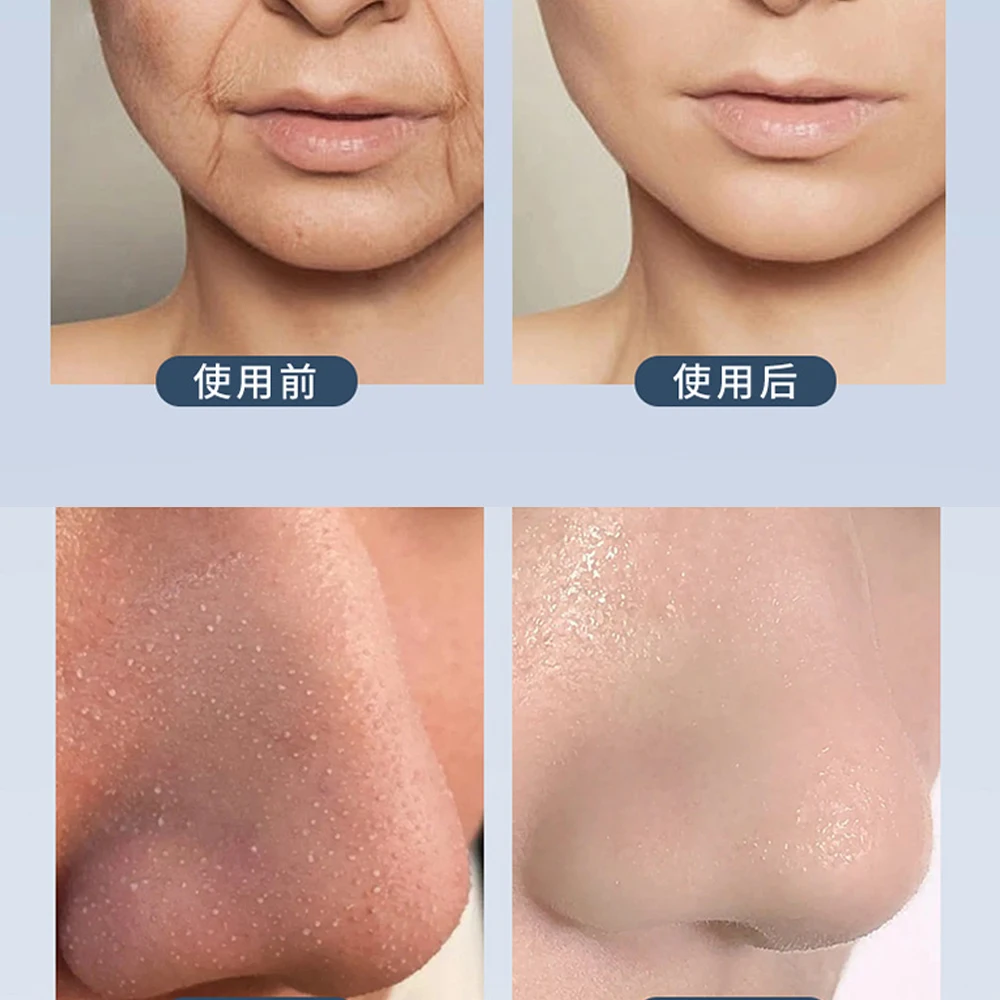 Small Bubble of Hydrogen Oxygen Bubbles Small Bubble Machine Facial Cleaning Machine Face Clean Cleansing Washing Machine