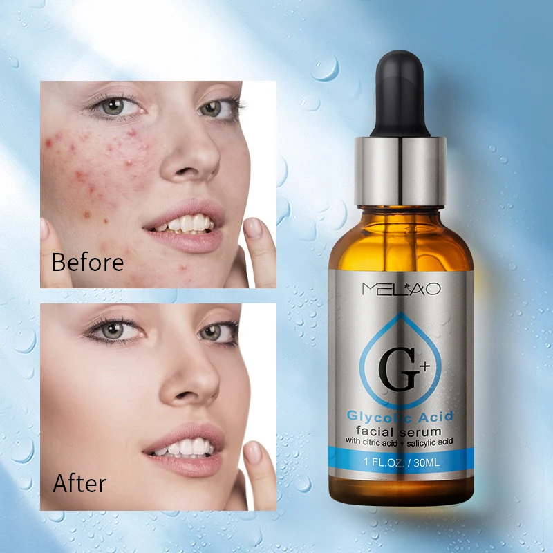 Wholesale Hot selling Private Label Natural organic Anti-aging Smooth Wrinkles Anti Acne Treatment Collagen Glycolic Acid serum