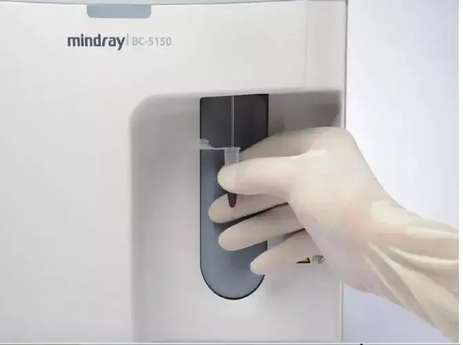 Mindray BC6000/6200/6800 Original Reagent Lyse Diluent for 5 parts auto Hematology Analyzer blood analysis machine