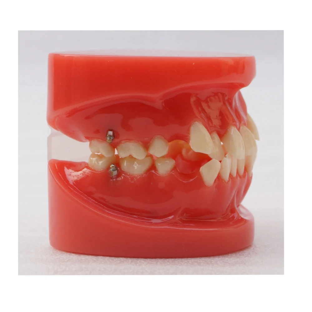 Dental Orthodontic Teeth Study Model Typodont Teeth Model 24Teeth