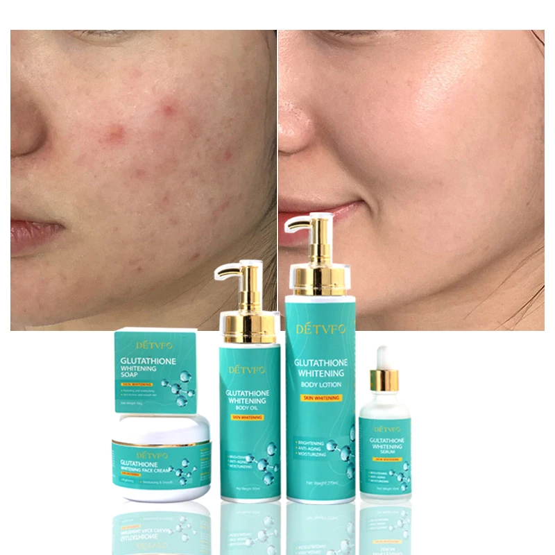 Hot sale Natural dark spot removal face serum body lotion oil soap double glutathione brightening whitening cream skin care set