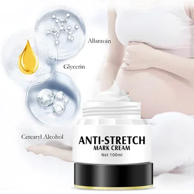 Hot Selling Remove Scars Acne Natural Lightening Anti Stretch Mark Cream For