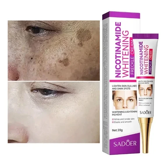 Whitening Cream Repairing Freckle Pigmentation Improving Dark Yellow Smoke Amide Reducing Melasma Facial Whitening Cream