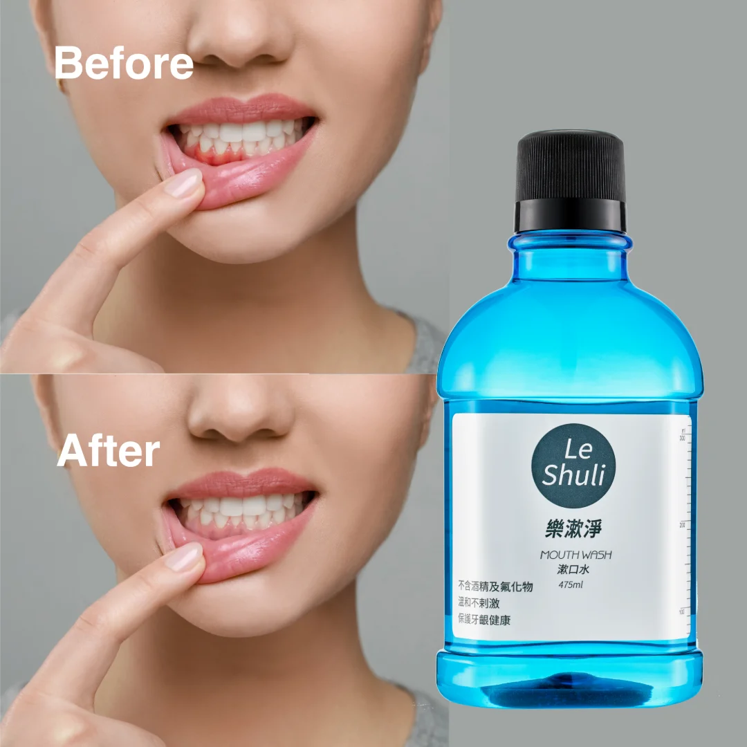 Prime Quality Alcohol-Free Mild Flavor Fresh Breath Mouthwash For Sensitive Oral Care