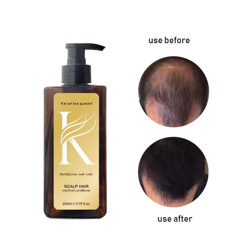 Private Label Herbal  anti Hair Loss  Ginger Shampoo And Conditioner oil hair Care Set