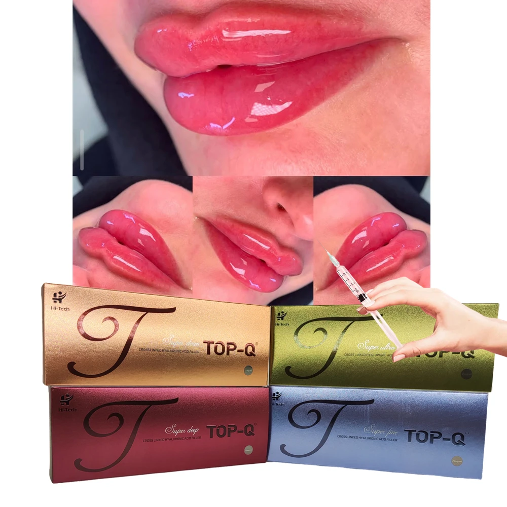 TOP-Q dermal filler hyaluronic acid 5cc Increased Volume For Lips Hyaluronic Acid Filler 2ml The Best Korea Manufacturer