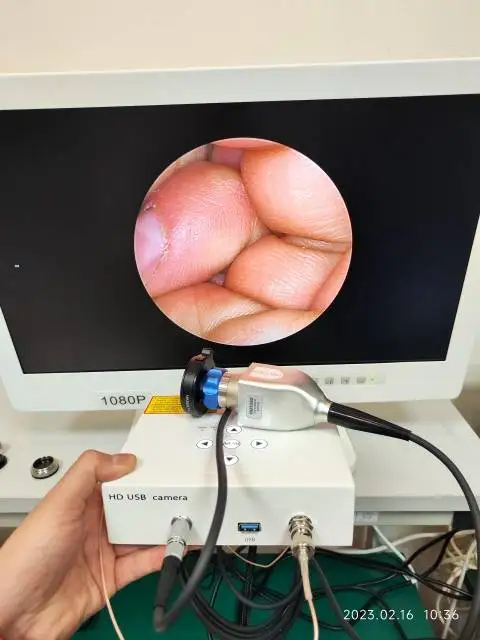 hospital clinic surgery usb endoscope system ent sinuscope camera price from china manufacturer