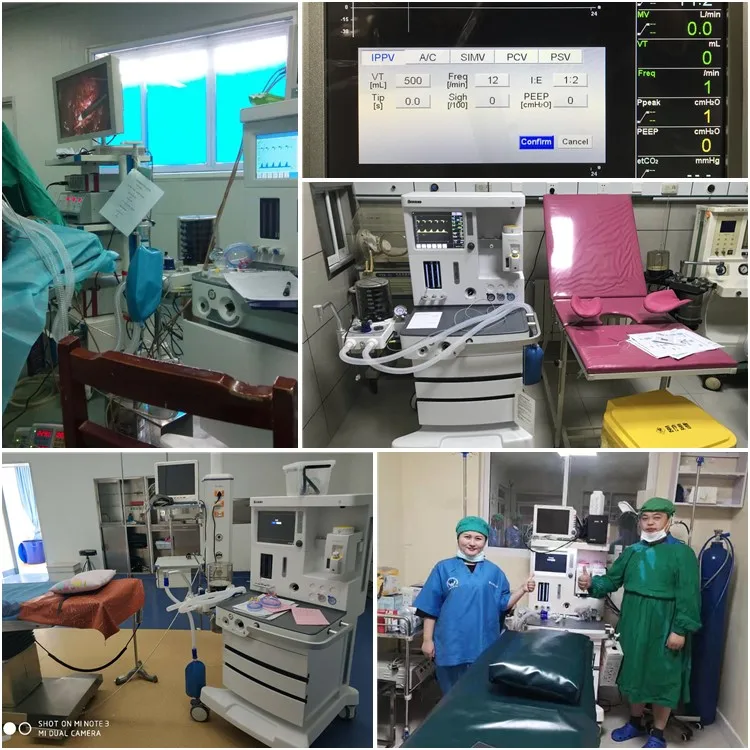 Ce Approved Priority Sound Visual Alarm Levels Displayed Anesthesia Delivery System