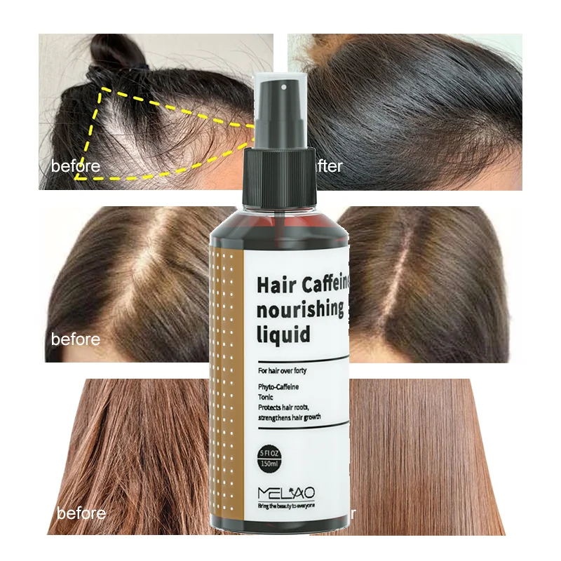 MELAO Caffeine Hair Tonic Nourishing Liquid Scalp Oil Control Hairs Growth Smooth Moisturize Strength Hair Care Spray