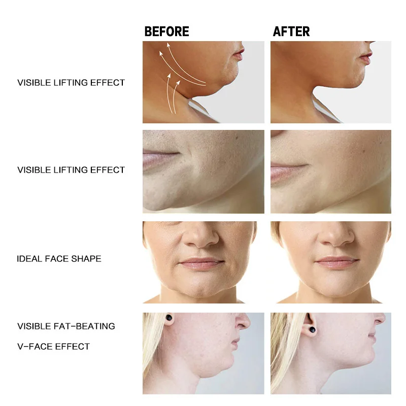 Anti wrinkle V-face lifting cream for skin relaxation and reducing fine lines facial moisturizing cream,