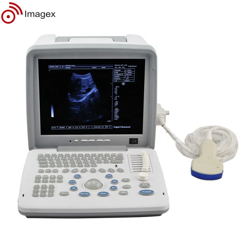 Factory Price Medical Ultrasound Scanner for Obstetric and Gynecological Use