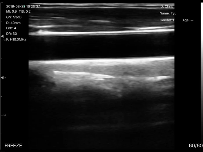 High Quality Double Head Ultrasound Convex and Linear Probe for Sale / Handheld Ultrasound Scanner Price