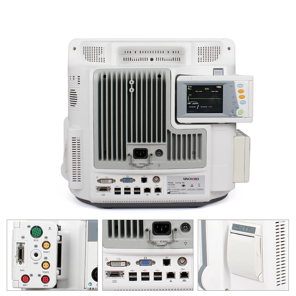 Hospital Ambulance High Resolution 17 inch Full Touch Screen Hospital ICU CCU Multi parameter Portable Patient Monitor