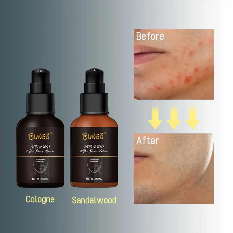 OEM Customized Men Care Lotion Hydrating And Nourishing After Shave