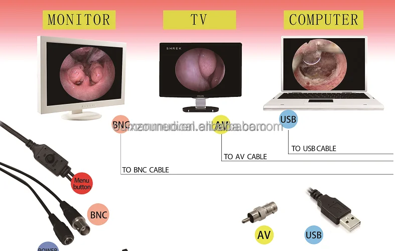 USB Portable endoscopy camera For All Endoscopic surgical