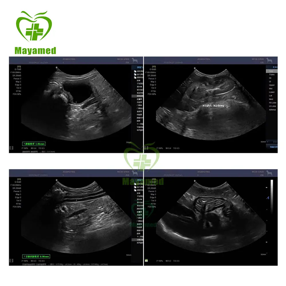 China Cheapest High Quality Pregnancy Portable Color Doppler Ultrasound Scanner, Medical 4D Portable Ultrasound Machine