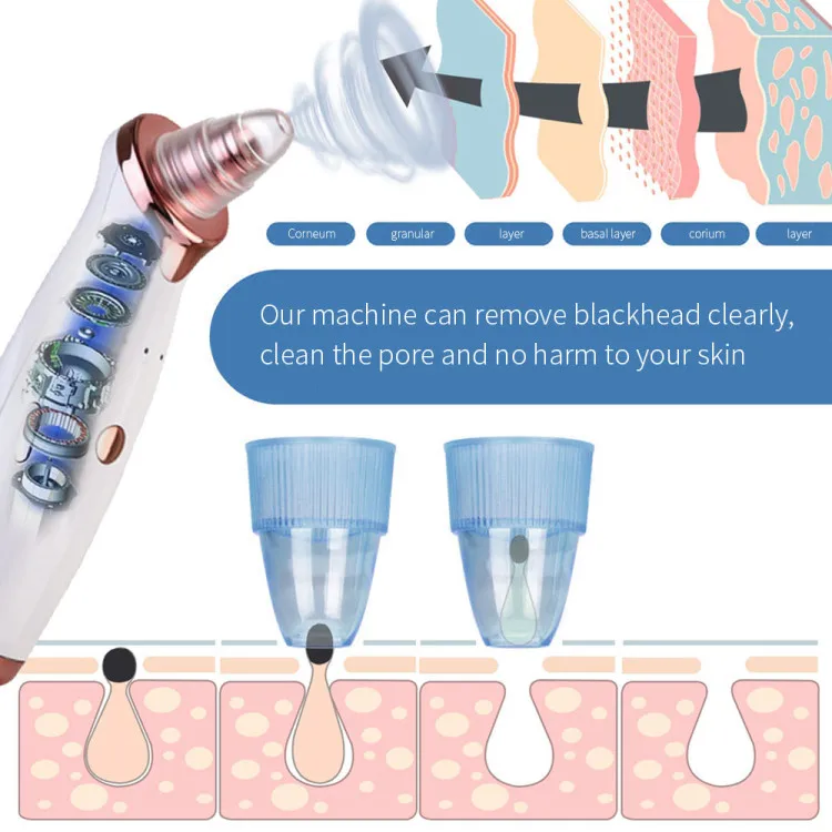 
5 Head Pore Cleanser Vacuum Electric Suction Facial Comedo Acne Remover Extractor Tool Kit Remover Vacuum Blackhead 5 Head Pore Cleanser Vacuum Electric Suction Facial Comedo Acne Remover Extractor Tool Kit &nbsp;Remover Vacuum Blackhead&nbsp;<img data-s