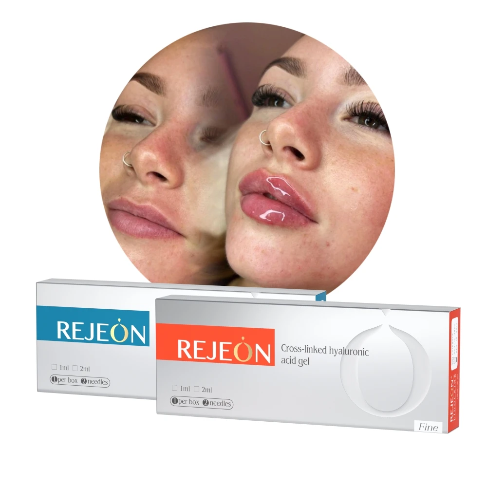 High quality hyaluronic acid skin booster original hyamax ultra dermal filler