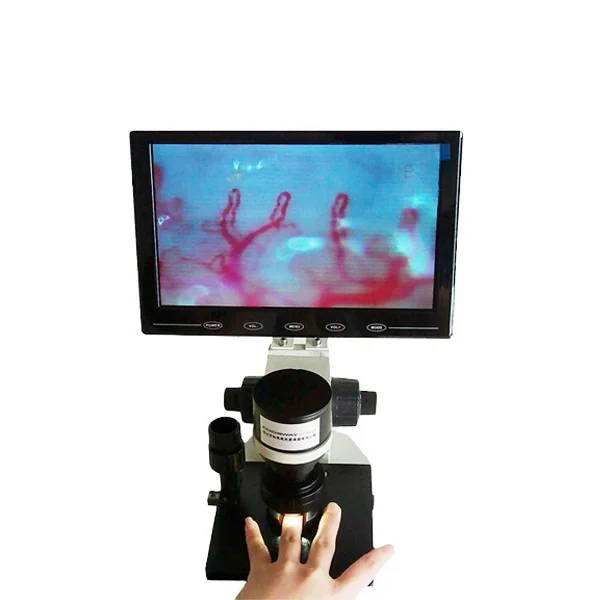 Latest micro circulation diagnostic machine digtial nailfold capillaroscopy