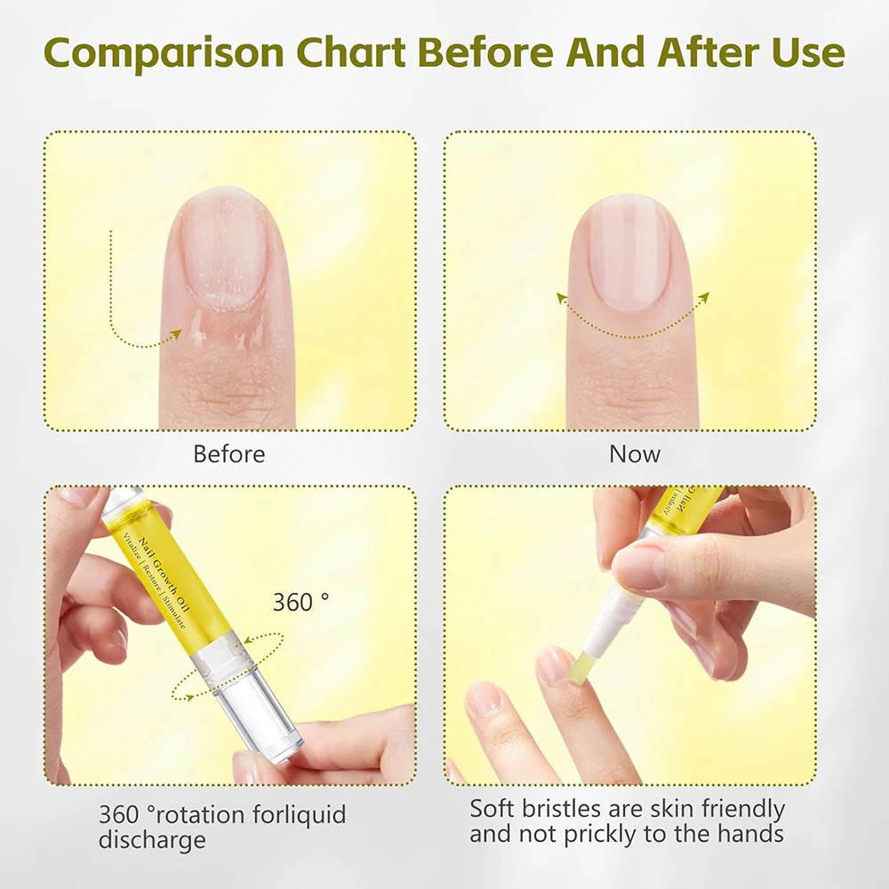 Wholesale Natural Vegan Nail Growth Oil Moisturizing Strengthening Cuticle Oil for Overall Nail Health Moisture Nail Care