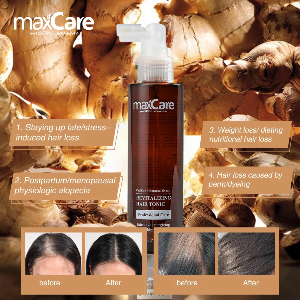 High-quality maxcare ginger hair tonic anti hair loss for hair grwoth