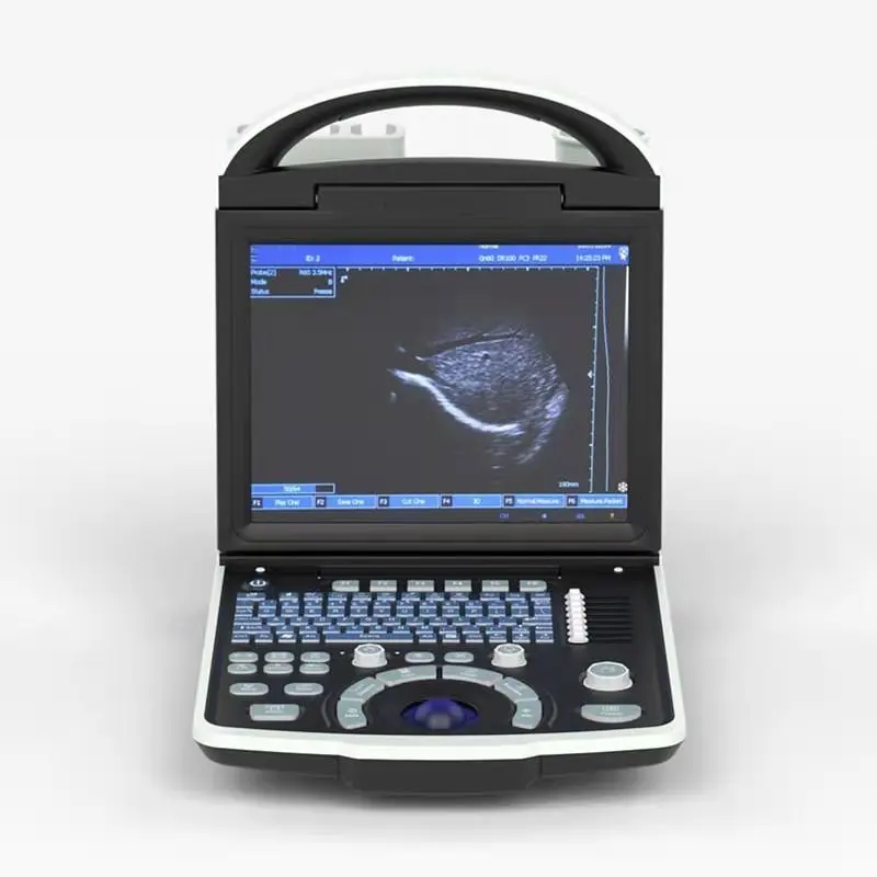 Portable B/W ultrasound scanner with convex probe  Mindray DP10 ultrasound Scanner
