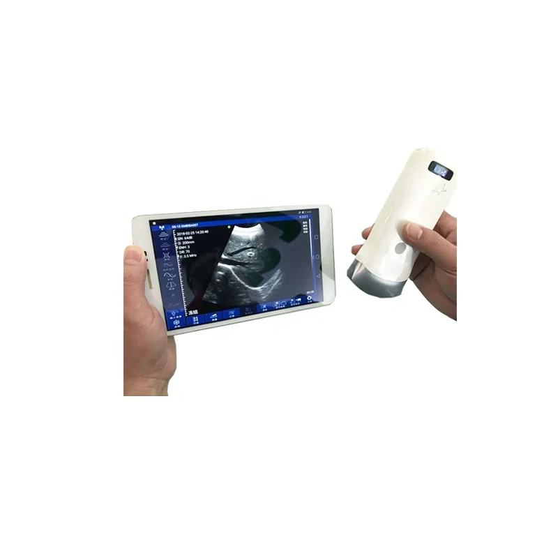 HD USB 5.5mm 720P HD Visual Endoscope Mini WIFI Control Eer Otoscope Camera