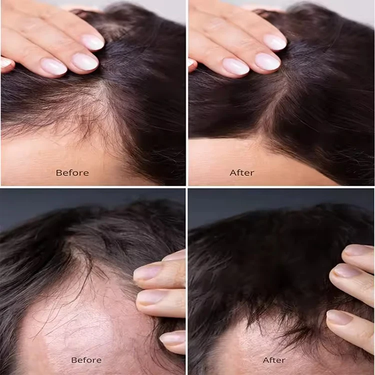 Private Label Natural Moisturizing Anti loss Hair Wash Vegan Hair Growth Biotin Shampoo And Conditioner Kit