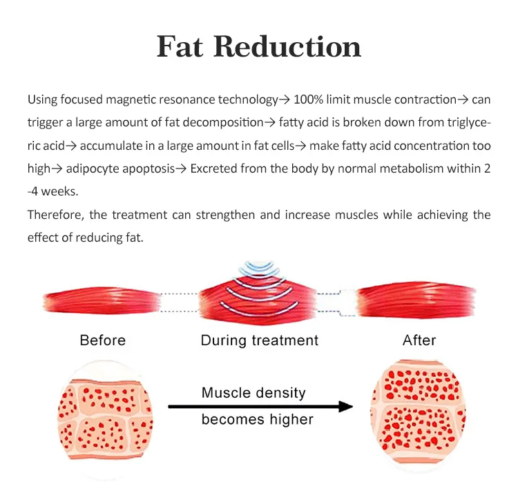 Non-invasive EMS Muscle Trainer Repair Stimulation Chair Muscle Body Sculpt Slim Magnetic Pelvic Floor Muscle Training Chair_9