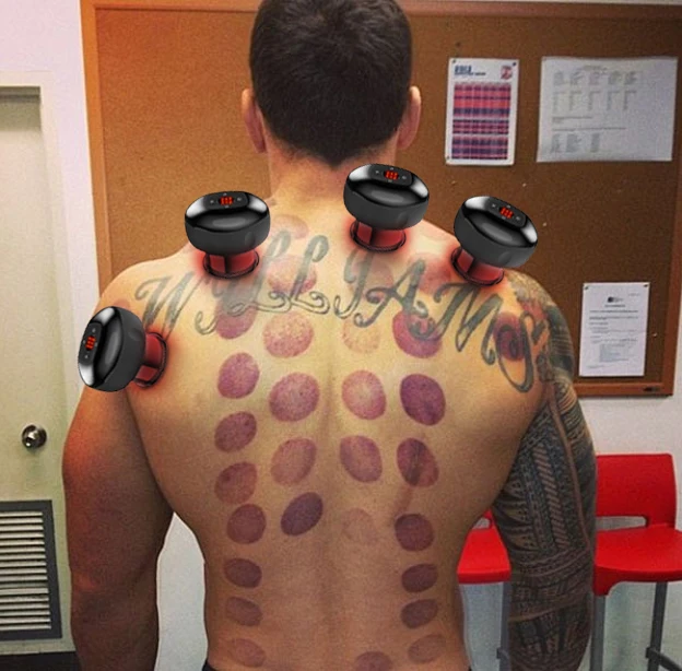 Amazon Hot Sale Intelligent Breathing Cupping Massage Instrument 6 Gears Vacuum Therapy Cupping Machine With Warming