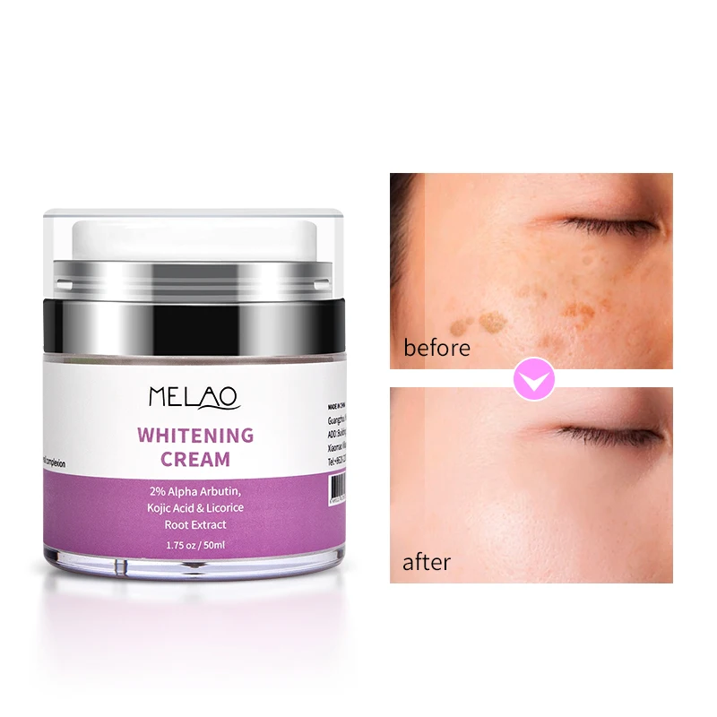 Wholesale Natural Ingredient Lightening Brightening Moisturizing Skin Whitening Cream For Face Body Bleaching