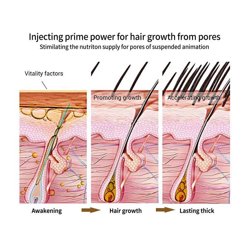 Private Label Batana Oil Organic Hair Regrowth 100% Natural Gginger Promote Hair Growth Shampoo OEM