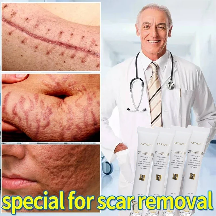 Strong Effective Acne Scar Removal Cream Pimples Stretch Marks Remove Face Gel Tummy Tuck Tightening Stretch Mark Removal Cream