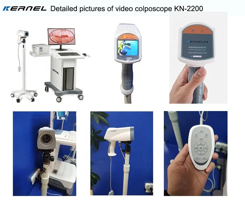 Kernel KN 2200 Handheld Colposcope Portable Gynecology Colposcopy System Digital Electronic Gynecology Video Colposcope