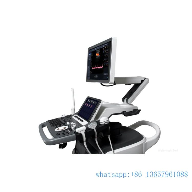 Ультразвук Sonoscape s50 4d лучше чем mindray dc 70