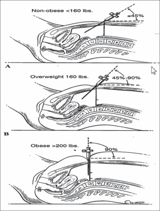 Профессиональные Многоразовые иглы для хирургических инструментов