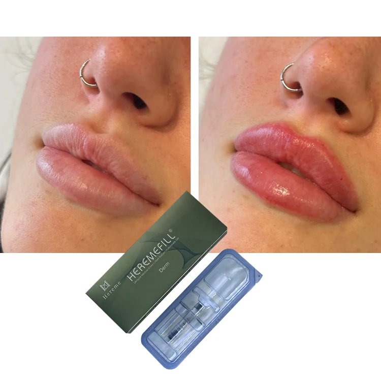 Heremefill Butt Enhancing Injections Buttock Enlarge Hyaluronic Acid Filler Injection 20ml