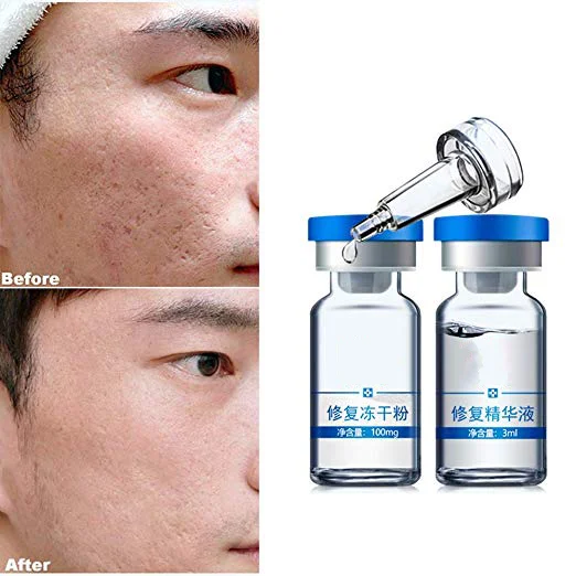 
Lyophilized Powder Acne Scar removal Serum Anti-wrinkles Organic and Natural Ingredients 