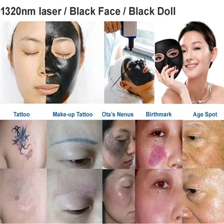 Care Hair Removal Laser Machine Ipl Laser Rf Hair Removal Skin Care Device To Remove Hair Brown