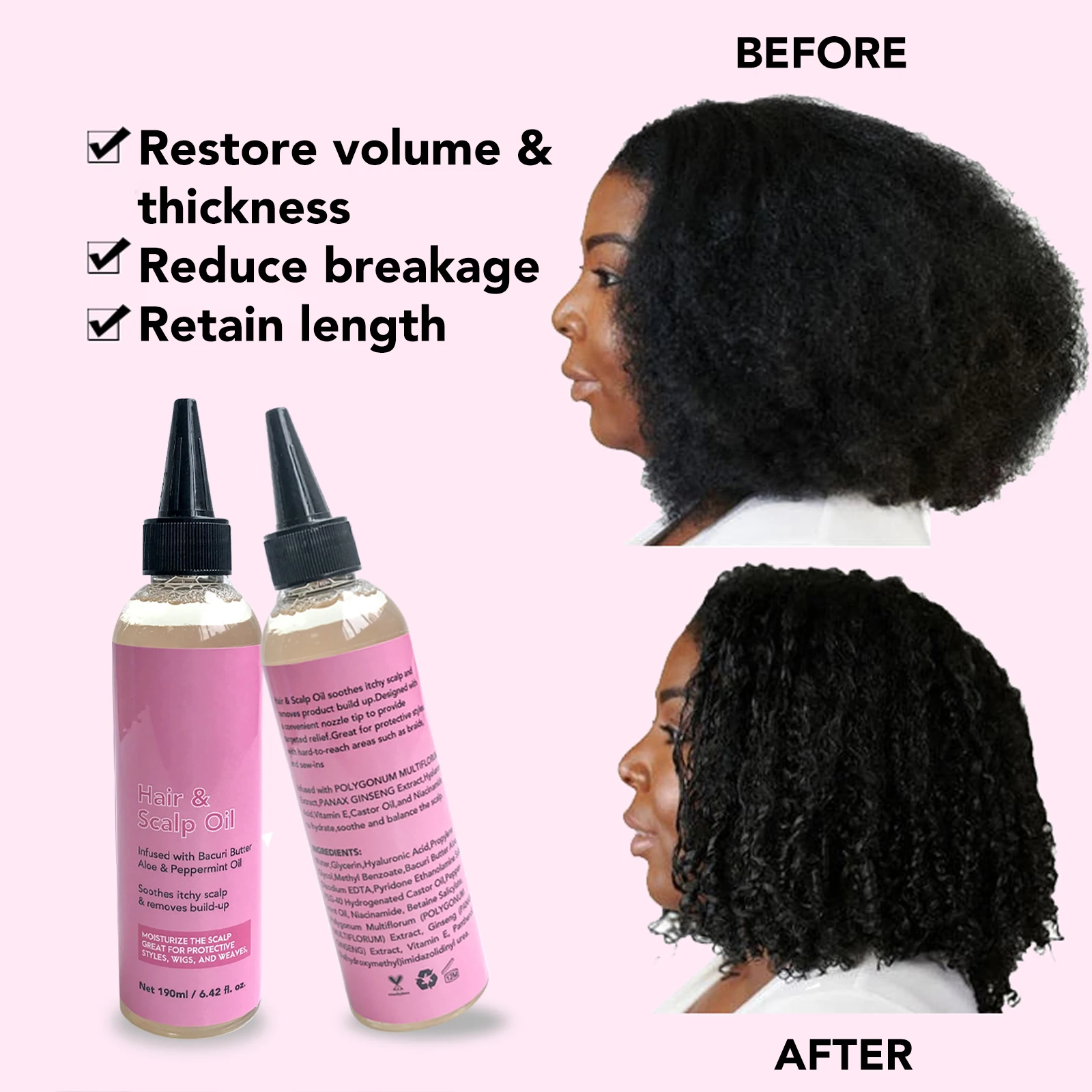 Scalp Serum Oil Hair Anti-Dandruff How To Make Anti-Dandruff Oil Straight Hair Oil Packaging Bottles