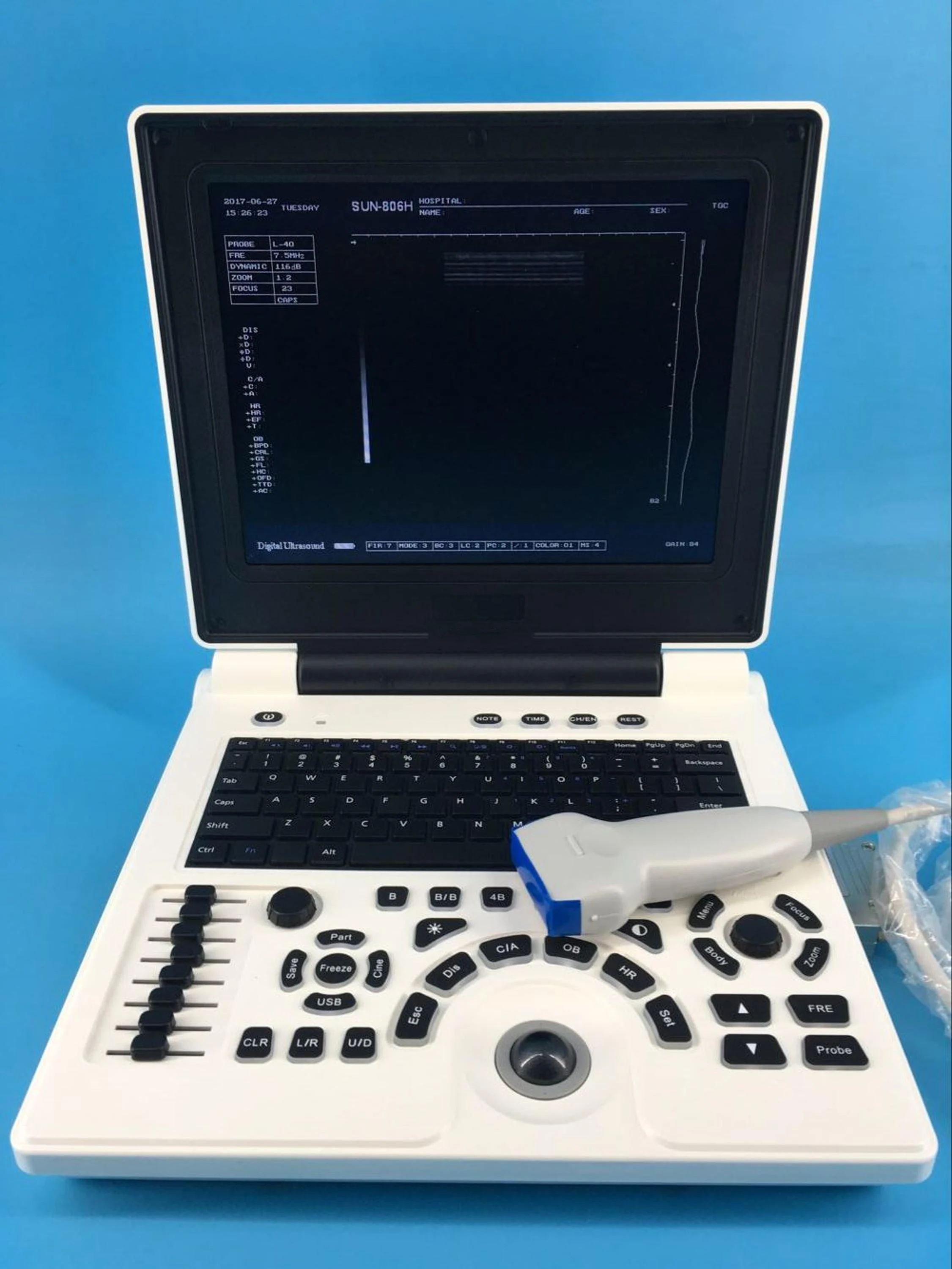 Medical Diagnostic B&W Portable Ultrasound Machine Ultrasound Scanner For Sale
