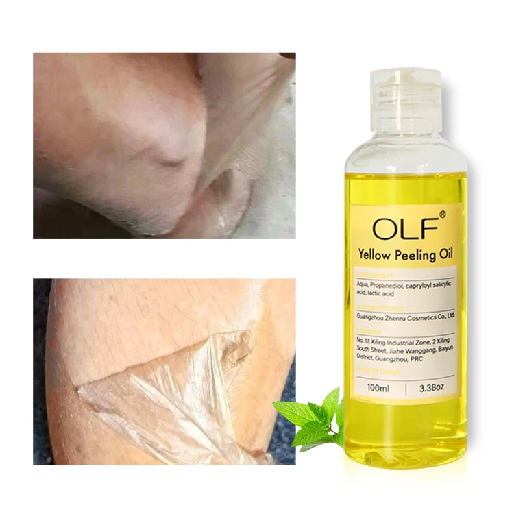 Private Label Wholesale Foot Peeling Spray Skin Type Dark Knuckles Legs Scars Body Extra Strong Green Orange Yellow Peeling Oil