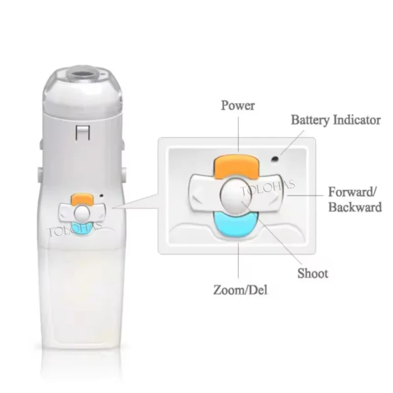 LHFFA2 Easy to use colposcopy female self observation equipment portable gynecological examination unit small video colposcope