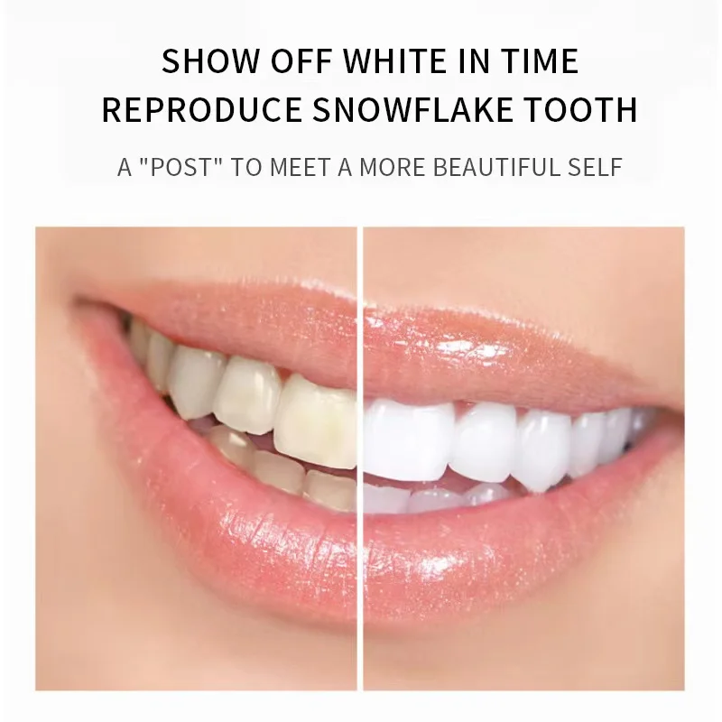 Private Label New Design Teeth Whitening Strips 6% HP Mint Flavor White Strips Teeth Whitening