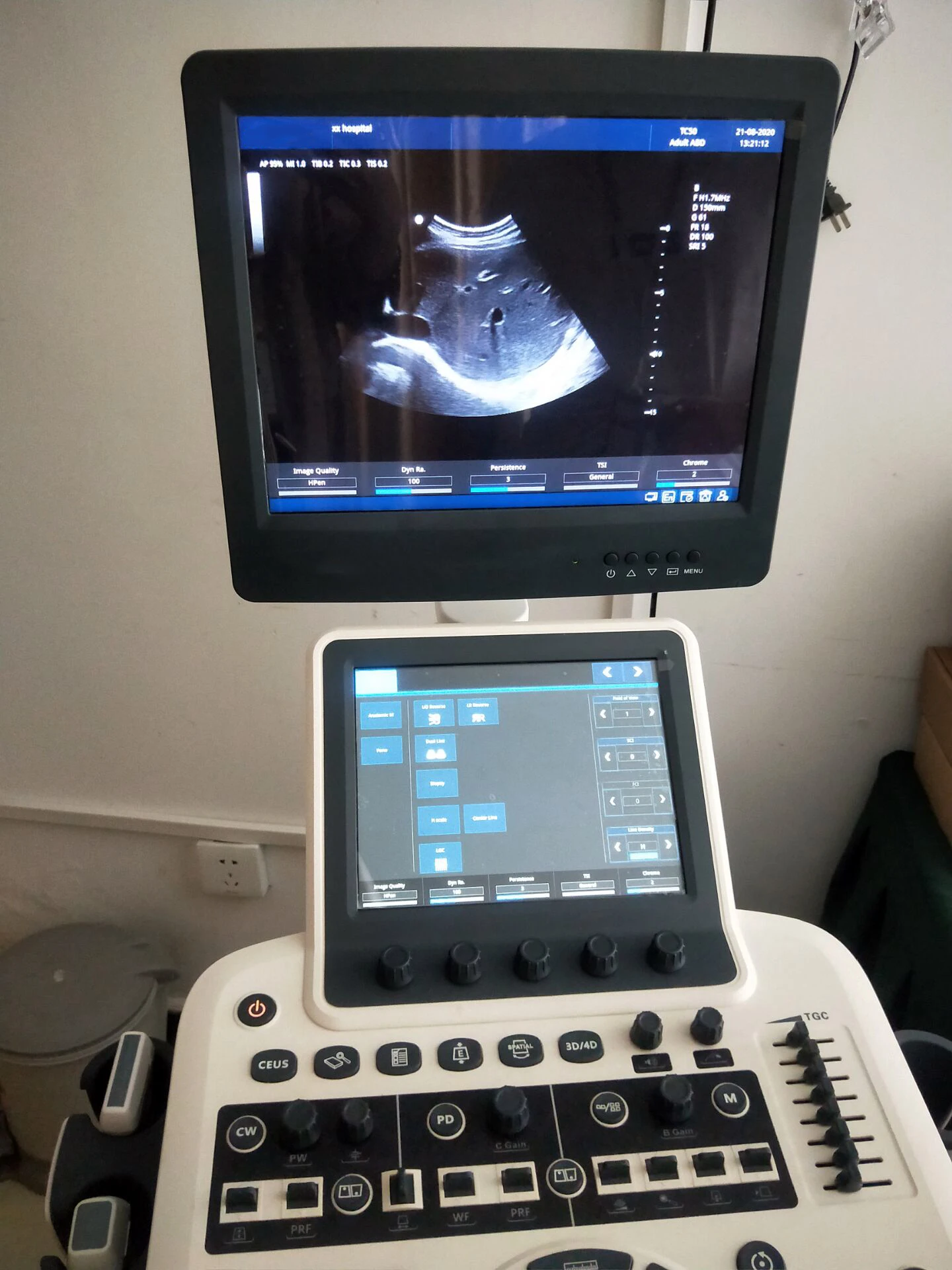 Полноценная цифровая тележка для беременных Цветной Допплер 4D ультразвуковое оборудование/Ультразвуковая машина цена