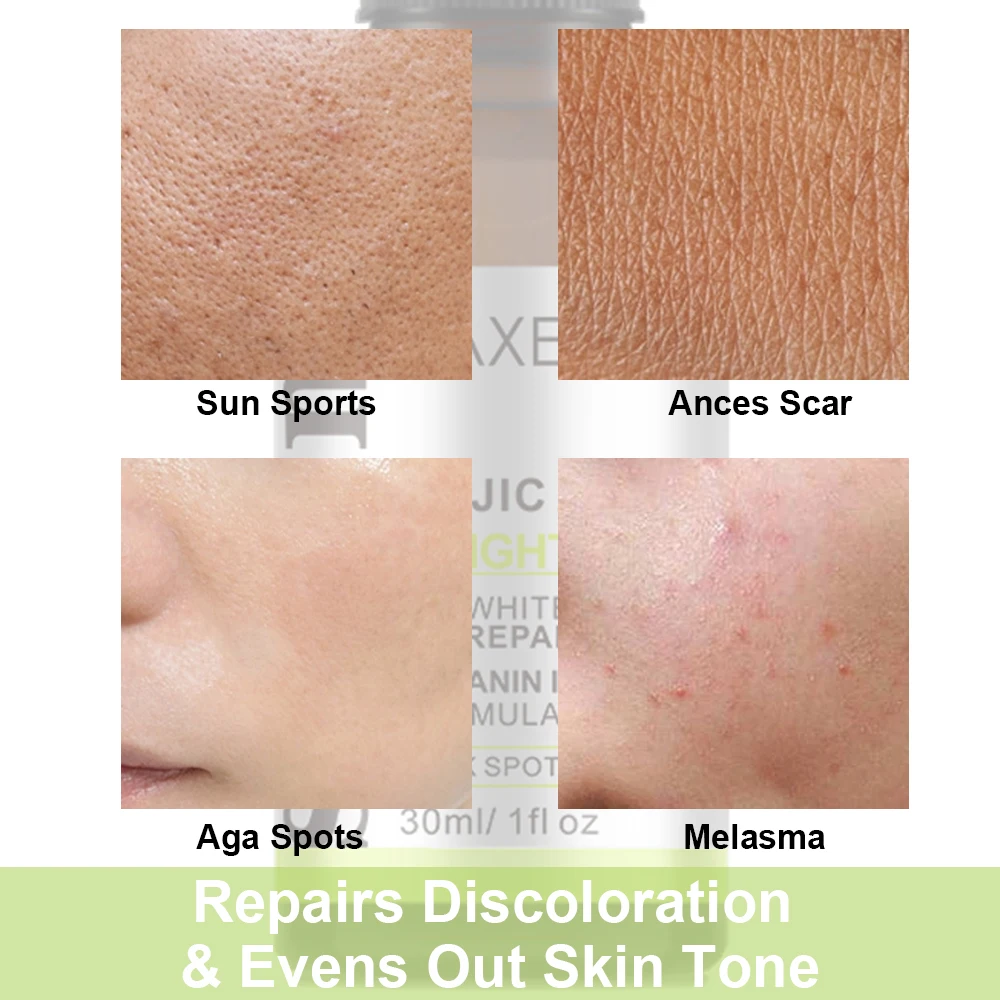Private Label Vitamin C Kojic Acid Dark Spot Serum Moisturizing Brightening Whitening Kojic Acid Skin Care Face Serum