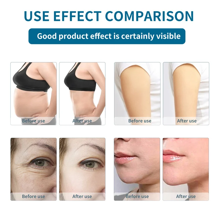 40K Portable Radiofrequency lipocavitation cellulite reduction massager radiofrecuencia facial y corporal body sculpting machine