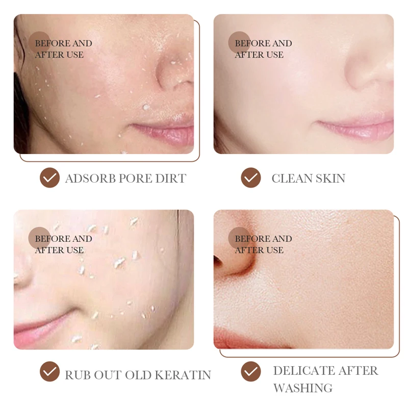 BIOAQUA Skin Care Body Scrub for Exfoliator Adults Female Peeling Body Care Gel Exfoliate Brighten Skin Exfoliator Cream OEM/ODM