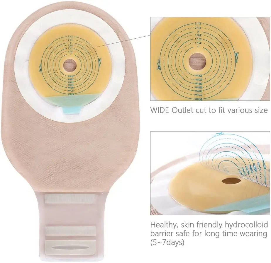 inflammatory bowel diseases used ostomy supplies Paediatric Ostomy Bags