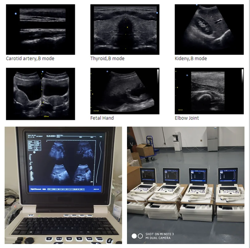Medical SUN-806H CE approved portable laptop vet pet animal veterinary ultrasound dog